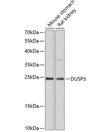 DUSP3 Rabbit Polyclonal Antibody