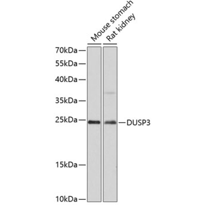 DUSP3 Rabbit Polyclonal Antibody