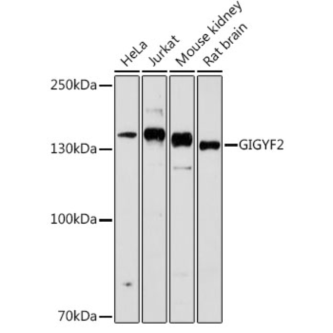 GIGYF2 Rabbit Polyclonal Antibody