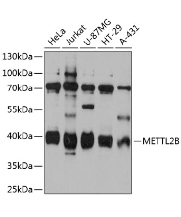 METTL2B Rabbit Polyclonal Antibody