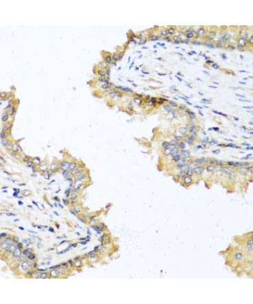 DEFB121 Rabbit Polyclonal Antibody
