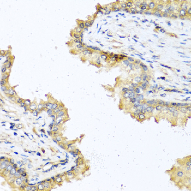 DEFB121 Rabbit Polyclonal Antibody