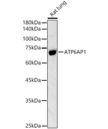 ATP6AP1 Rabbit Polyclonal Antibody