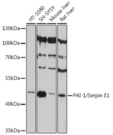 PAI-1/Serpin E1 Rabbit Polyclonal Antibody