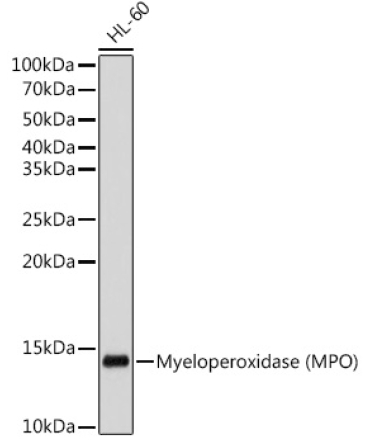 Myeloperoxidase (MPO) Rabbit Monoclonal Antibody