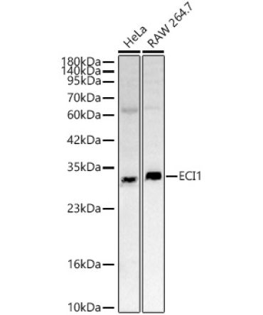 ECI1 Rabbit Polyclonal Antibody