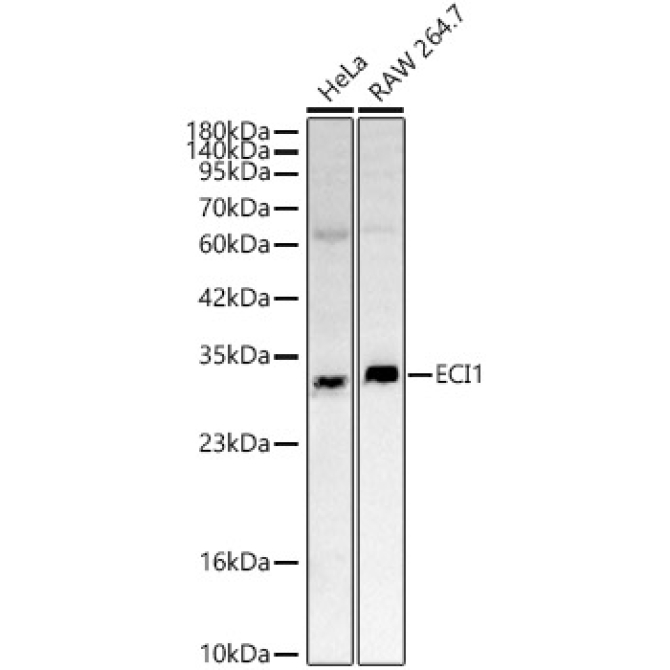 ECI1 Rabbit Polyclonal Antibody