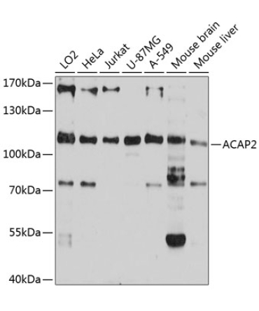 ACAP2 Rabbit Polyclonal Antibody