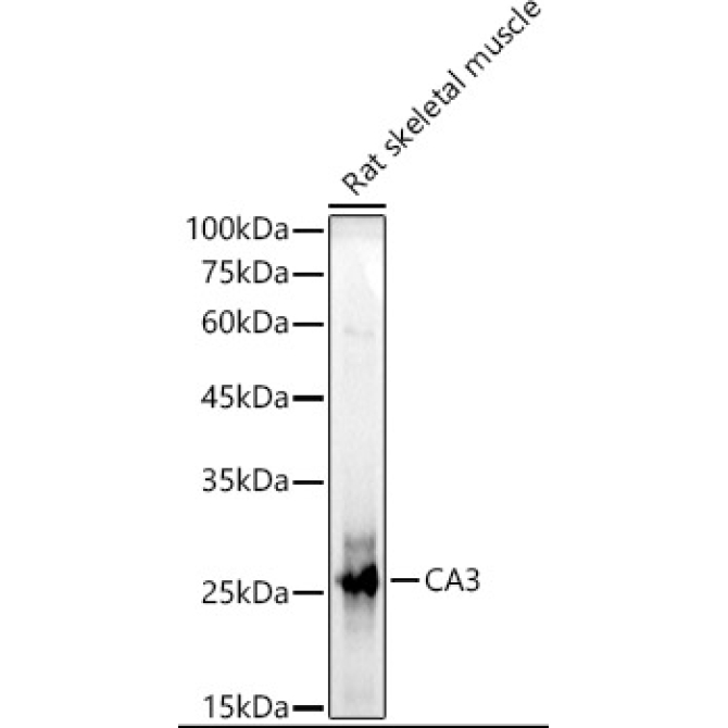 CA3 Rabbit Polyclonal Antibody
