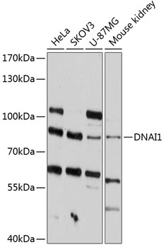 DNAI1 Rabbit Polyclonal Antibody