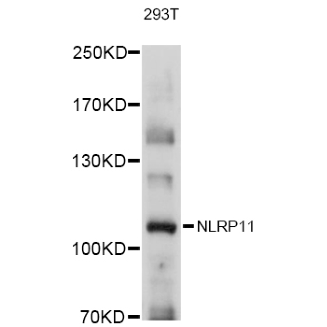 NLRP11 Rabbit Polyclonal Antibody