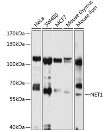 NET1 Rabbit Polyclonal Antibody