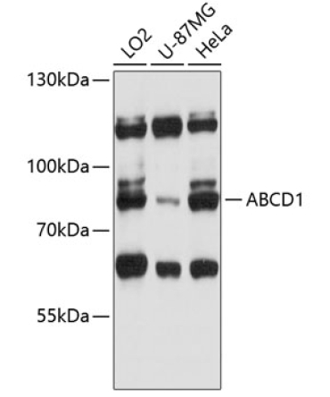 ABCD1 Rabbit Polyclonal Antibody