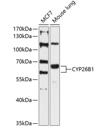 CYP26B1 Rabbit Polyclonal Antibody