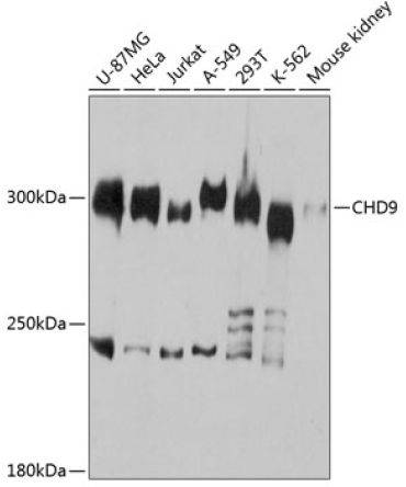 CHD9 Rabbit Polyclonal Antibody