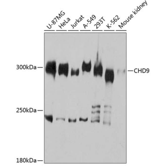 CHD9 Rabbit Polyclonal Antibody