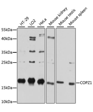 COPZ1 Rabbit Polyclonal Antibody