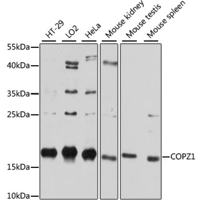 COPZ1 Rabbit Polyclonal Antibody