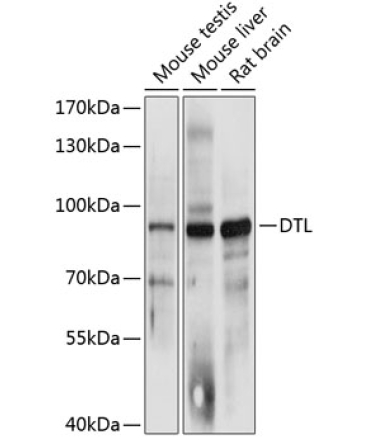 DTL Rabbit Polyclonal Antibody