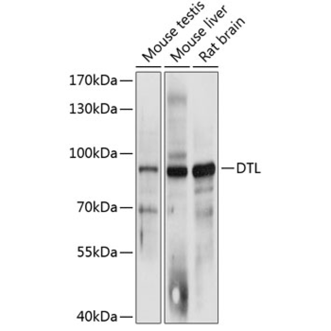 DTL Rabbit Polyclonal Antibody