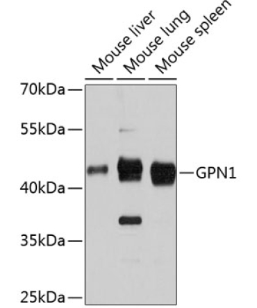 GPN1 Rabbit Polyclonal Antibody