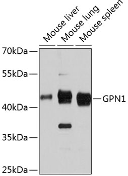 GPN1 Rabbit Polyclonal Antibody