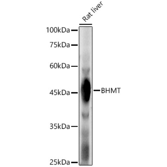 BHMT Rabbit Polyclonal Antibody