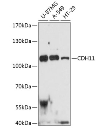 CDH11 Rabbit Polyclonal Antibody