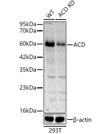 ACD Rabbit Polyclonal Antibody