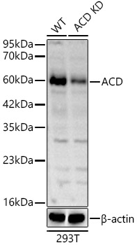 ACD Rabbit Polyclonal Antibody