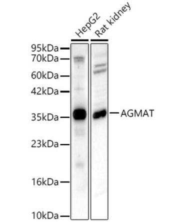 AGMAT Rabbit Polyclonal Antibody