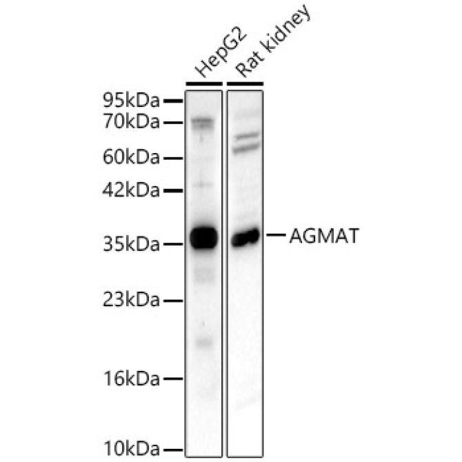 AGMAT Rabbit Polyclonal Antibody