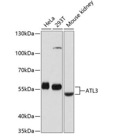 ATL3 Rabbit Polyclonal Antibody