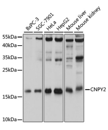 CNPY2 Rabbit Polyclonal Antibody