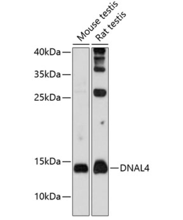 DNAL4 Rabbit Polyclonal Antibody