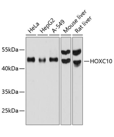 HOXC10 Rabbit Polyclonal Antibody
