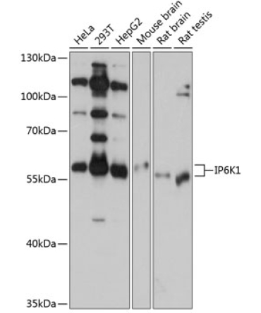 IP6K1 Rabbit Polyclonal Antibody