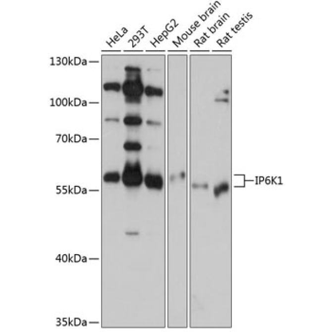 IP6K1 Rabbit Polyclonal Antibody