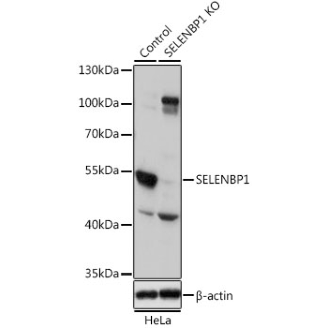 SELENBP1 Rabbit Polyclonal Antibody [KO Validated]