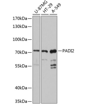 PADI2 Rabbit Polyclonal Antibody