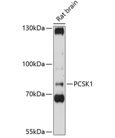 PCSK1 Rabbit Polyclonal Antibody