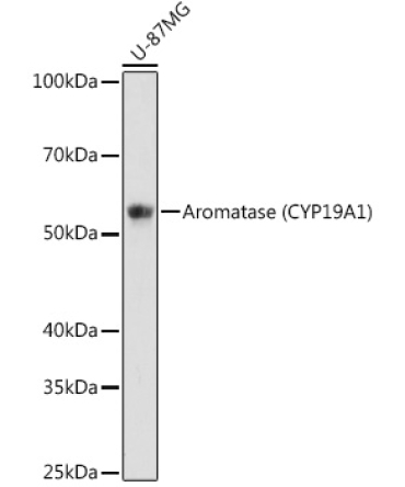 Aromatase (CYP19A1) Rabbit Monoclonal Antibody