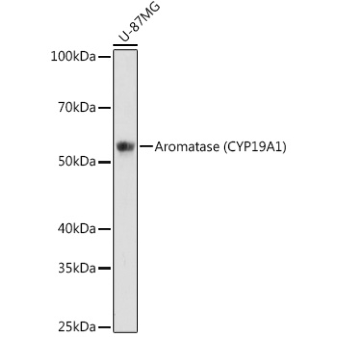 Aromatase (CYP19A1) Rabbit Monoclonal Antibody
