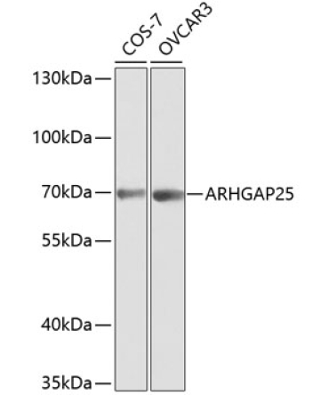 ARHGAP25 Rabbit Polyclonal Antibody