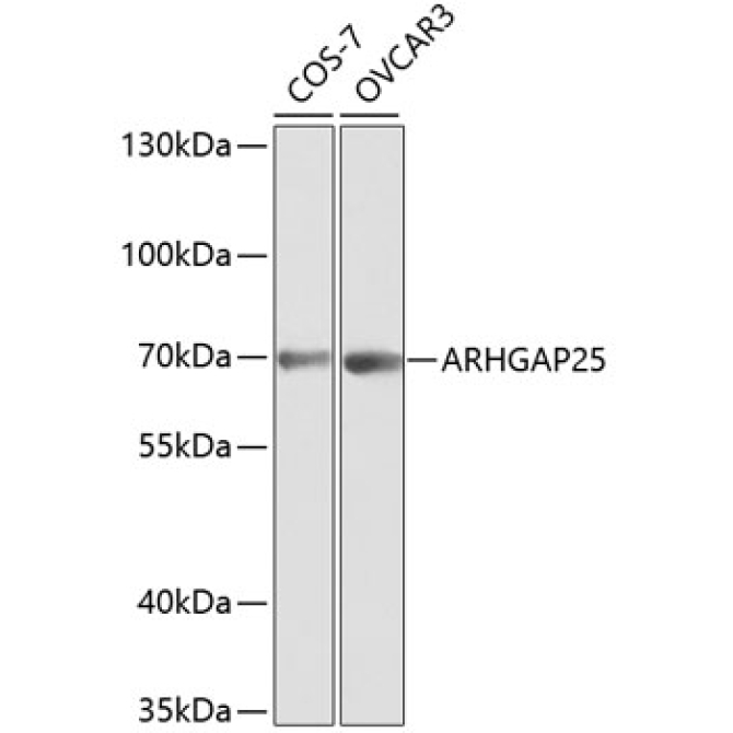 ARHGAP25 Rabbit Polyclonal Antibody