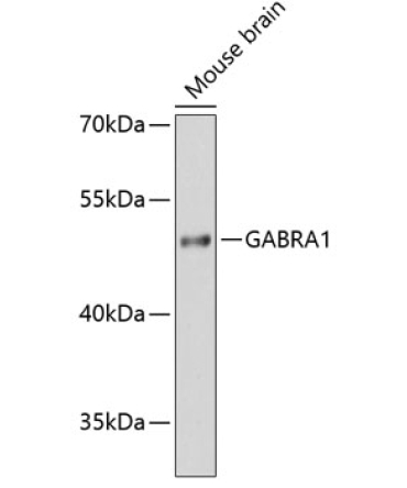 GABRA1 Rabbit Polyclonal Antibody