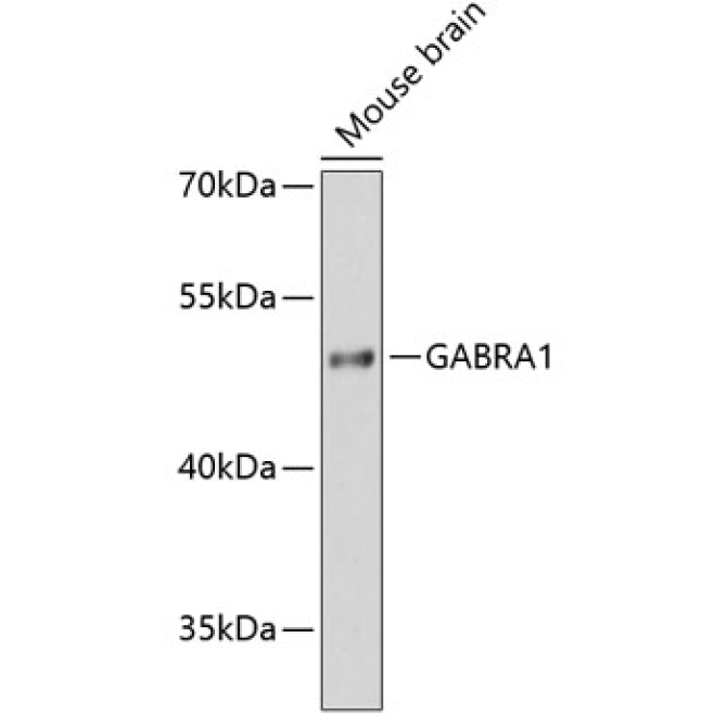 GABRA1 Rabbit Polyclonal Antibody