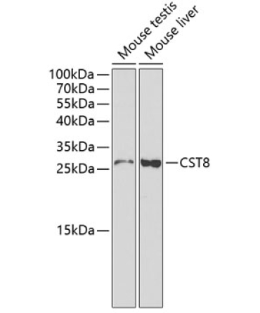 CST8 Rabbit Polyclonal Antibody