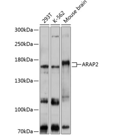 ARAP2 Rabbit Polyclonal Antibody
