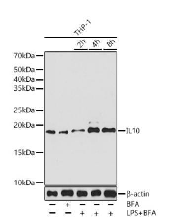 IL10 Rabbit Monoclonal Antibody